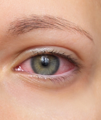 About condition right